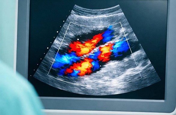 Возможности допплера в УЗИ - Новости - Медерика Набережные Челны